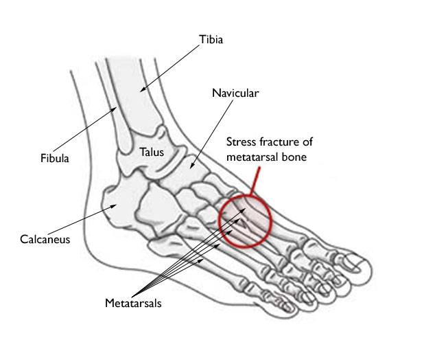 physio foot injury