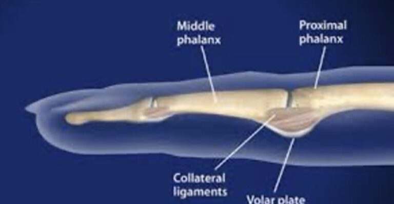 Pip Injection Finger Understanding finger injuries of the PIP joint - Port Melbourne ...